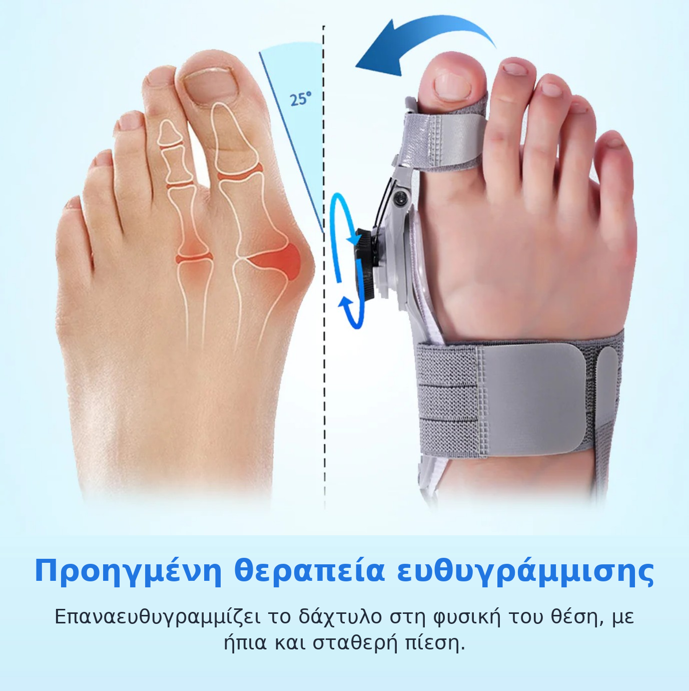 OrthoStep™ – Коректор за палци (халукс валгус) без операция