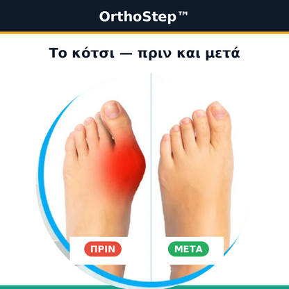 OrthoStep™ – Коректор за палци (халукс валгус) без операция