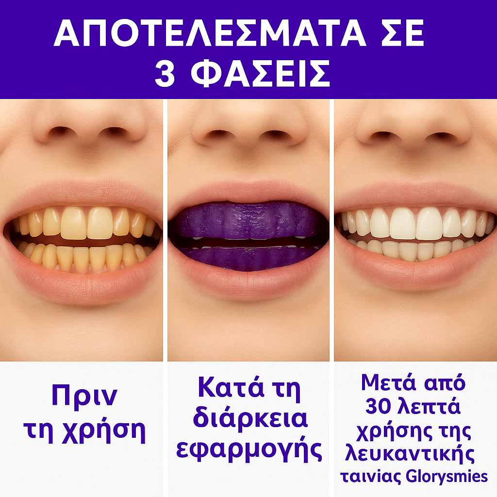 Λευκαντικές Ταινίες V34