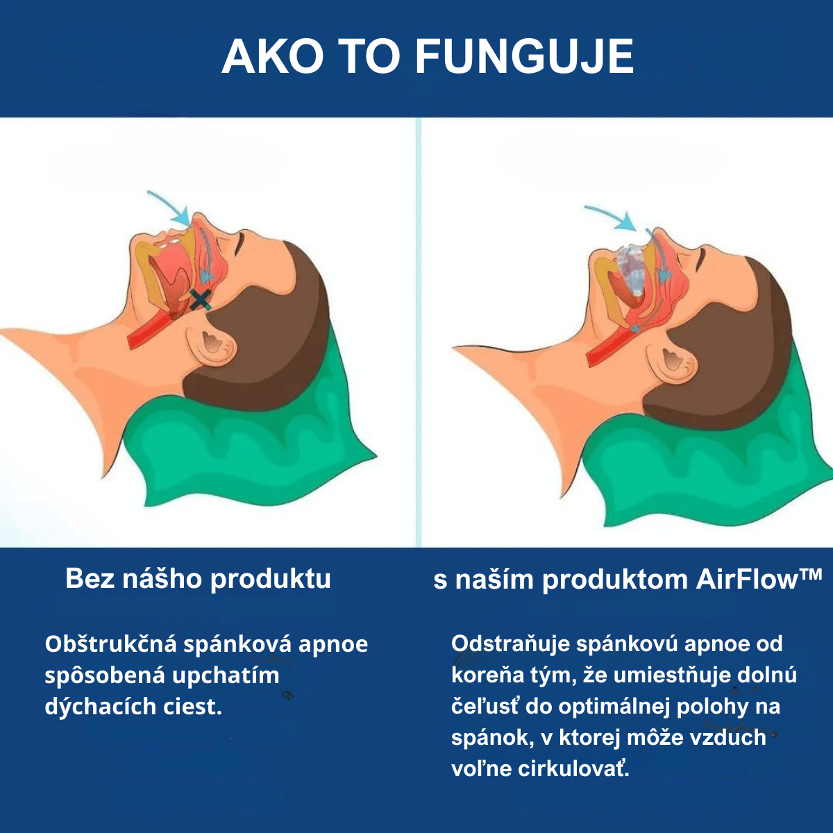 AirFlow™ – Zariadenie proti chrápaniu a spánkovému apnoe